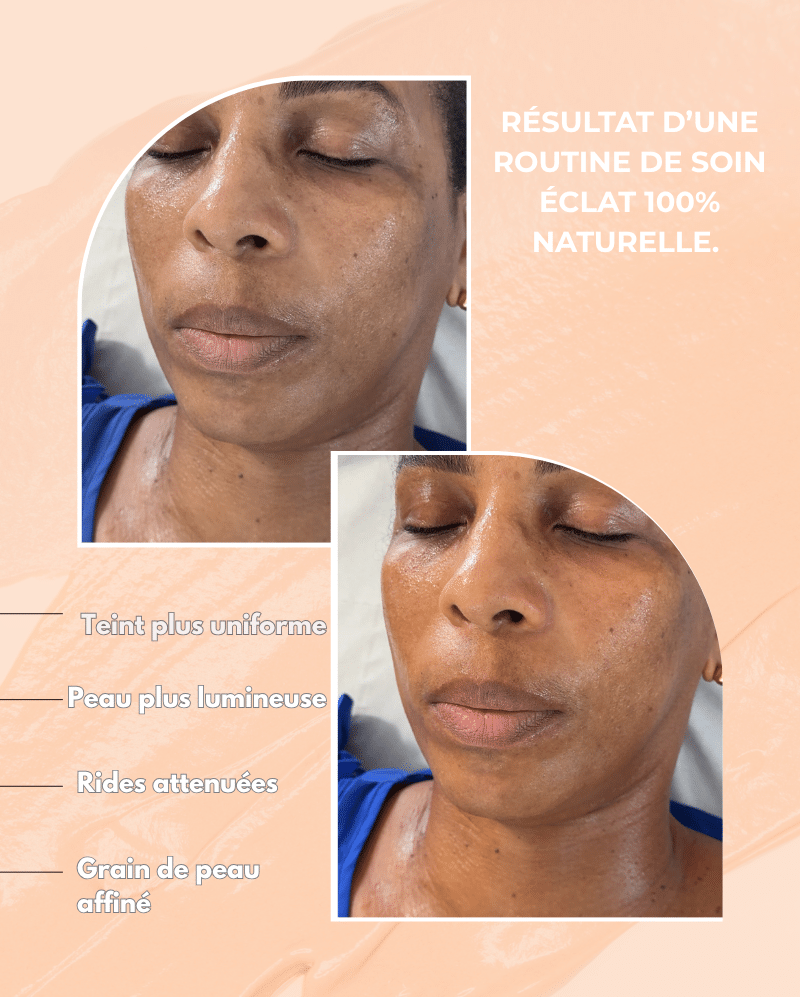 Avant après routine éclat glow box skinscosmeactive- peau lumineuse, teint unifié, ride atténuées, grain de peau affiné