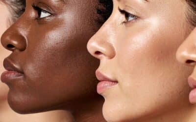 Taches pigmentaires sur peau noire :La routine naturelle qui change tout.
